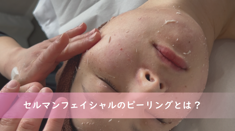 セルマン　　ピーリング　ヒーリング AK Esthetics熊本 | . セルマンピーリング2回目 洗顔＋セラム